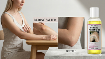 Why Your Skin Feels Softer After Peeling — Even Weeks Later