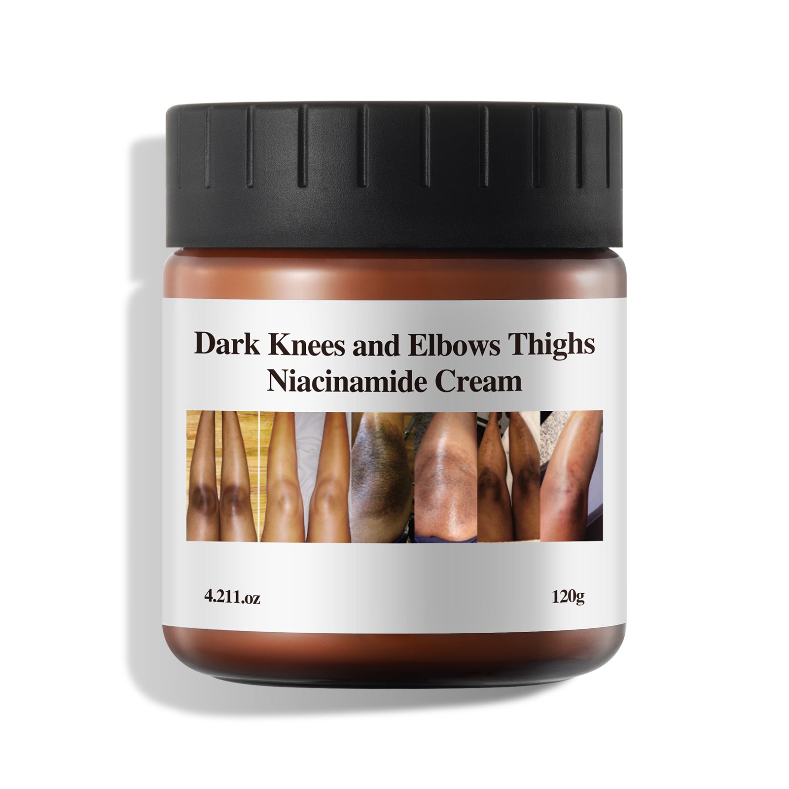 Dark Knees and Elbows Thighs Niacinamide Cream