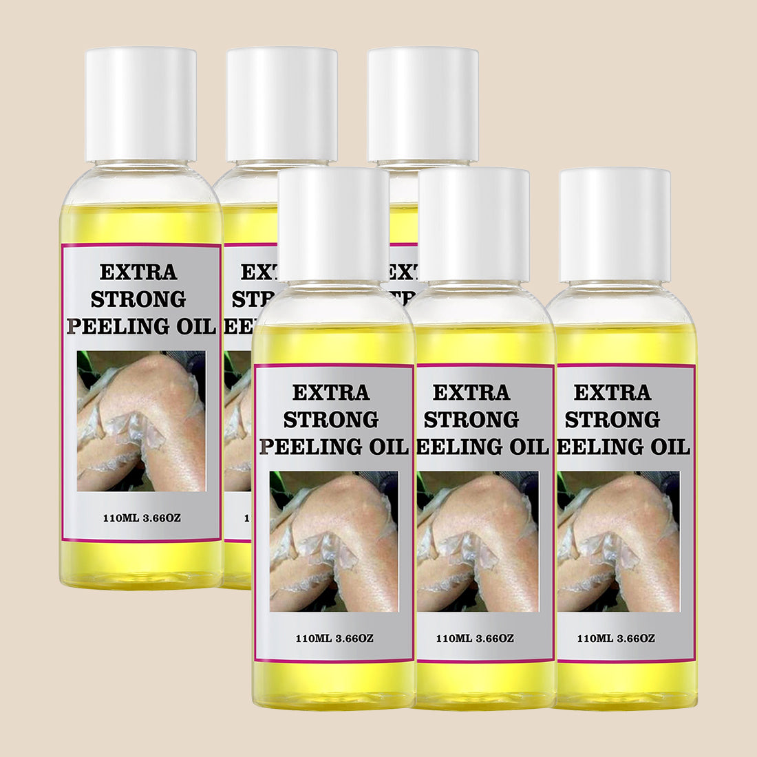 YAFUSIPE Yellow Peeling Oil for Dark Skin Strong Peel Oil Extra Strength Exfoliating Chemical Exfoliant Peels Solution at Home Body Peeling for Exfoliate Body Hand Foot Knuckle All Skin Type 3.66 OZ