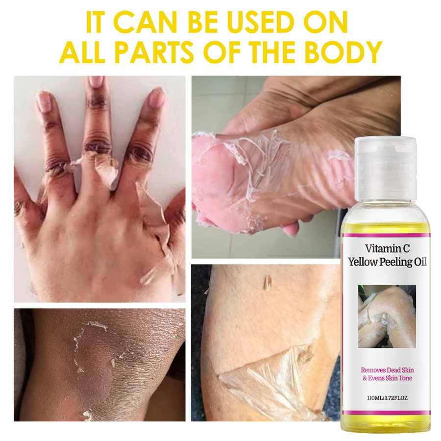 YAFUSIPE VC Starkes Gelbes Peeling-Öl Extra Stärke für dunkle Haut – Vitamin C Körper-Peeling & chemisches Peeling