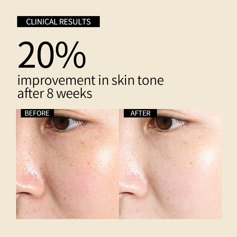 YAFUSIPE Skincare Suero de vitamina C - Cuidado de la piel para manchas oscuras, suero de vitamina C para la cara con ácido hialurónico y vitamina E - Fórmula antienvejecimiento e iluminadora de la piel con vitamina C para el cuidado facial 1 Fl Oz