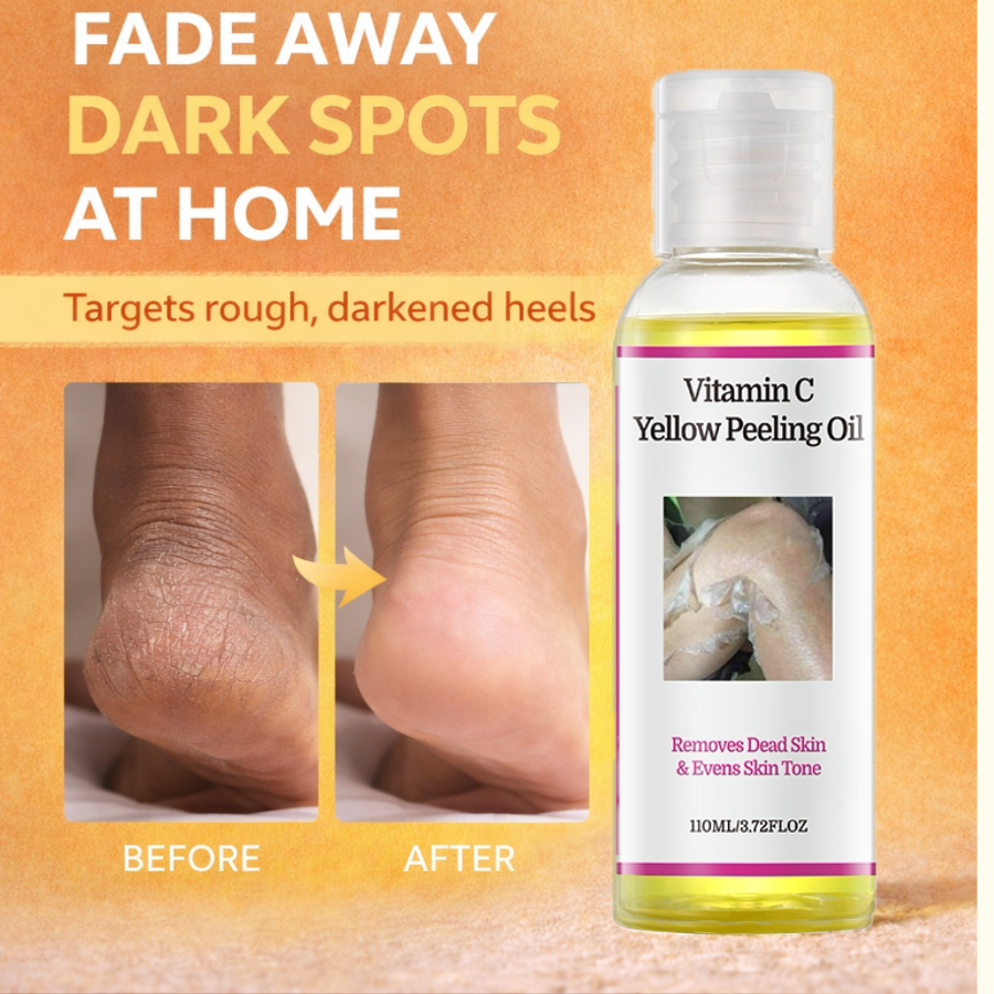 YAFUSIPE VC Starkes Gelbes Peeling-Öl Extra Stärke für dunkle Haut – Vitamin C Körper-Peeling & chemisches Peeling