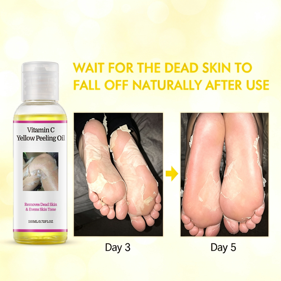 YAFUSIPE VC Starkes Gelbes Peeling-Öl Extra Stärke für dunkle Haut – Vitamin C Körper-Peeling & chemisches Peeling
