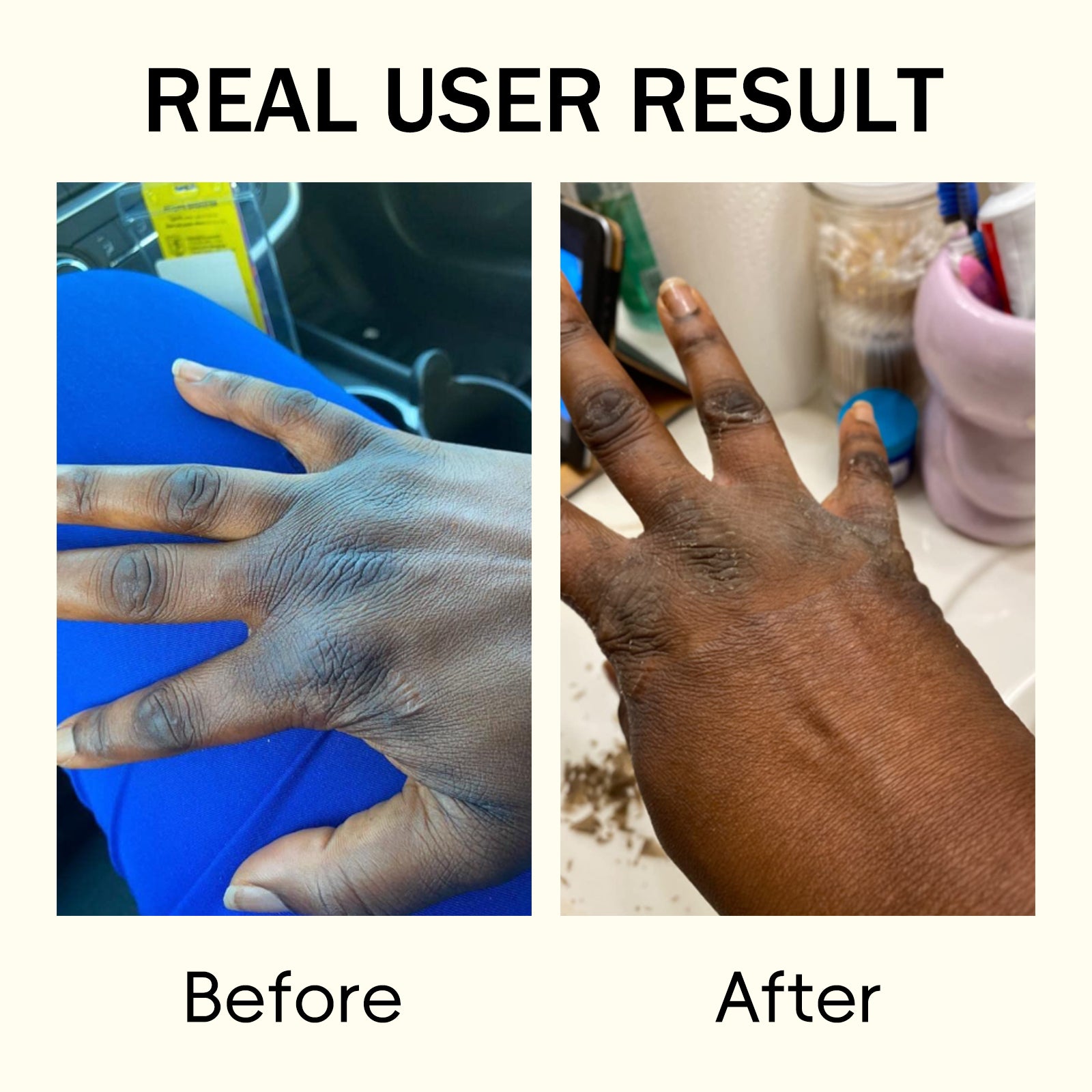 YAFUSIPE Yellow Peeling Oil For Body Exfoliator