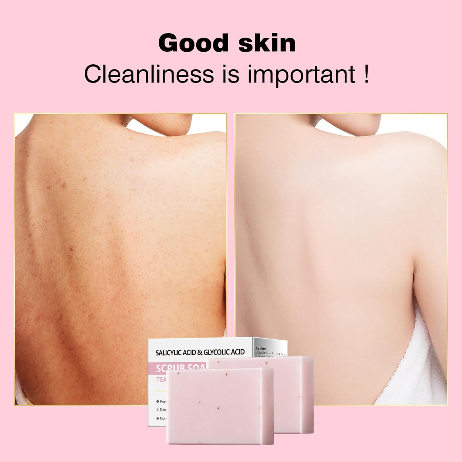 Salicylic Acid Scrub Soap, Face Bath Soap Bar with Glycolic Acid Tea Tree, Exfoliating Face Body Wash for Women & Men Anti-blemish Acne Strawberry Legs Ingrown Hair Keratosis Pilaris 200g/7OZ