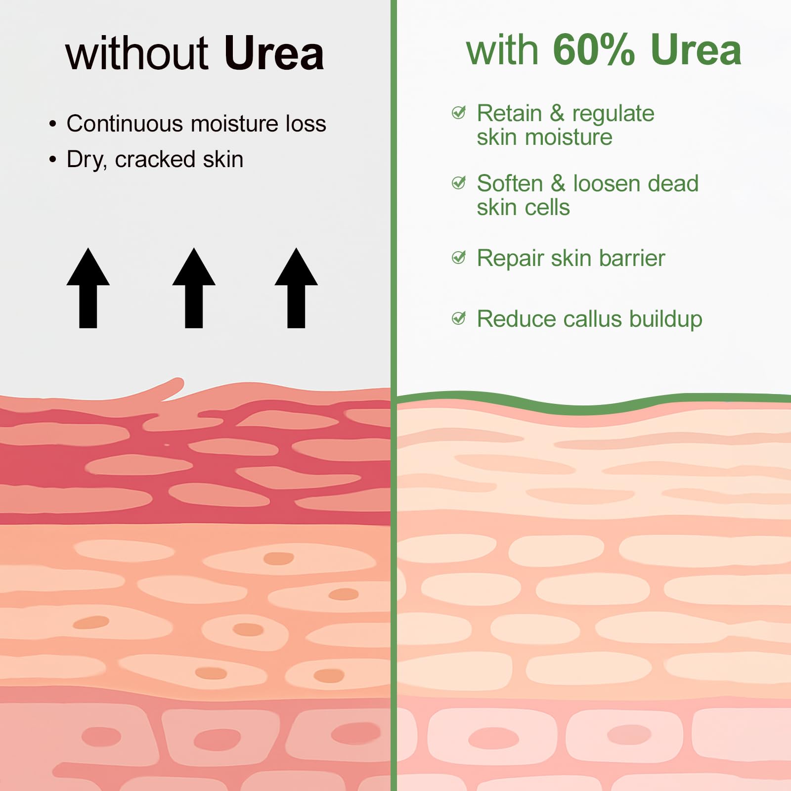 60% Urea Cream Stick plus 2% Salicylic Acid,Foot Callus Remover - Urea Cream 60% for Feet Cracked Skin, Dry Cracked Feet & Hands Moisturizer, Foot Care Balm 1.4oz
