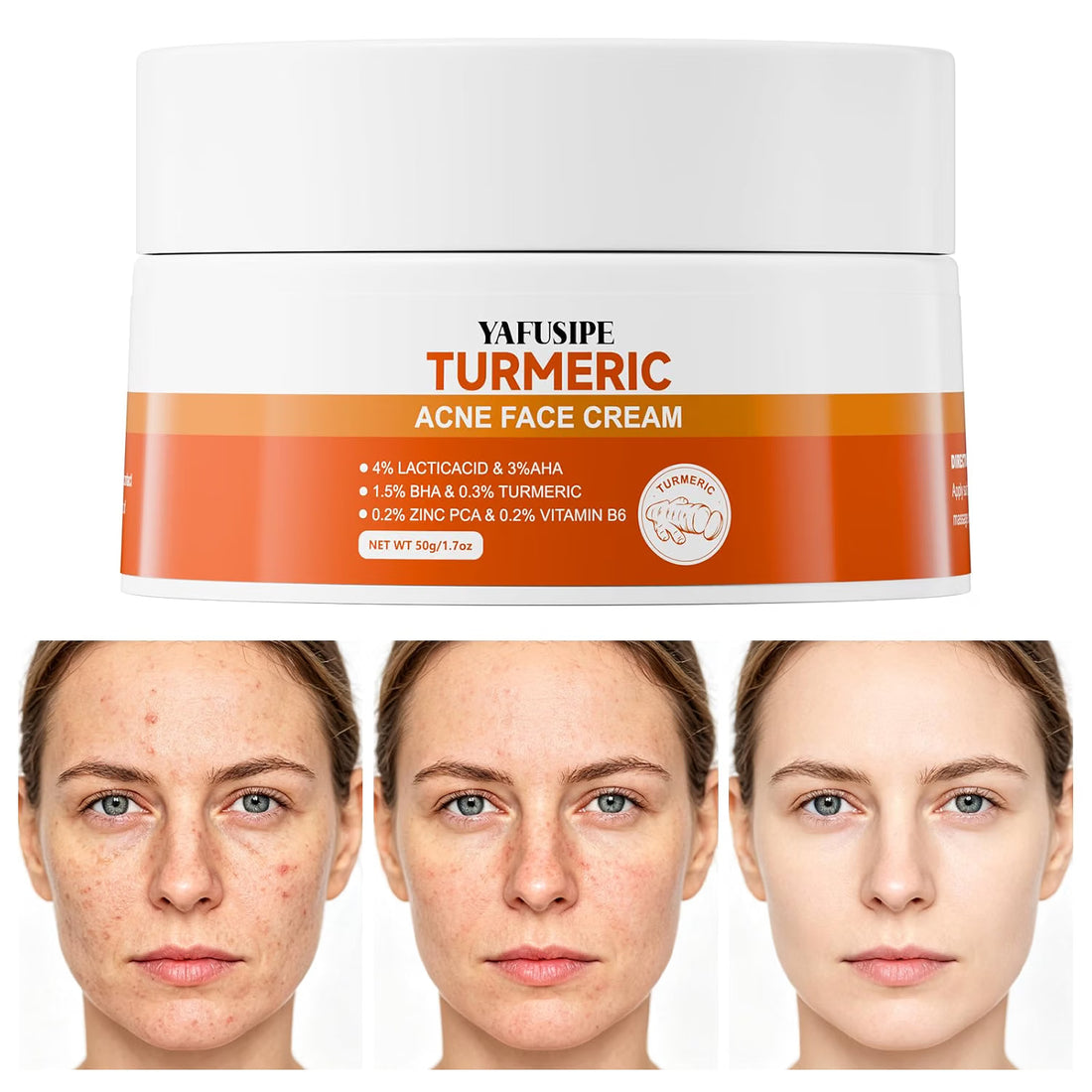 YAFUSIPE Turmeric Acne Cream Pimple Spot Treatment for Face Back Body Butt 1.7OZ