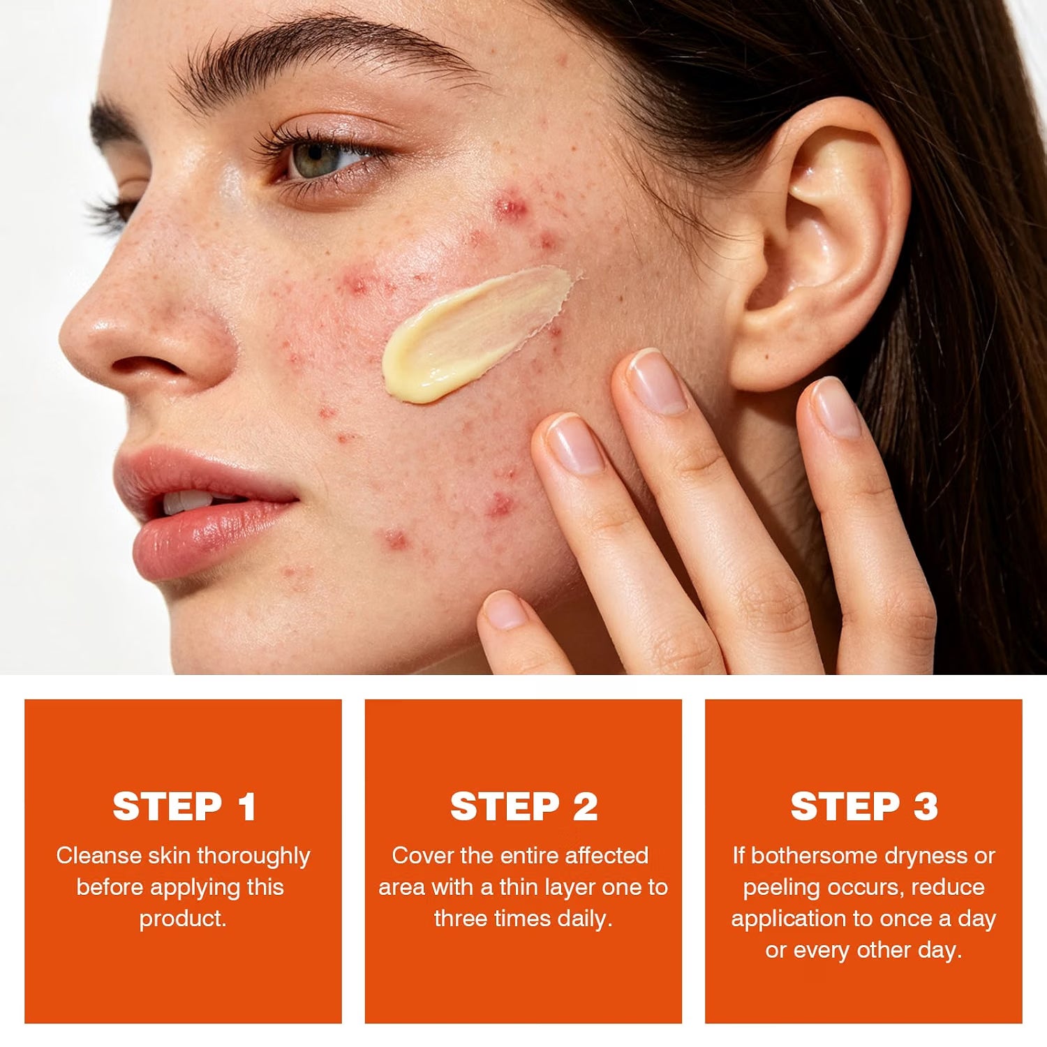 YAFUSIPE Turmeric Acne Cream Pimple Spot Treatment for Face Back Body Butt 1.7OZ