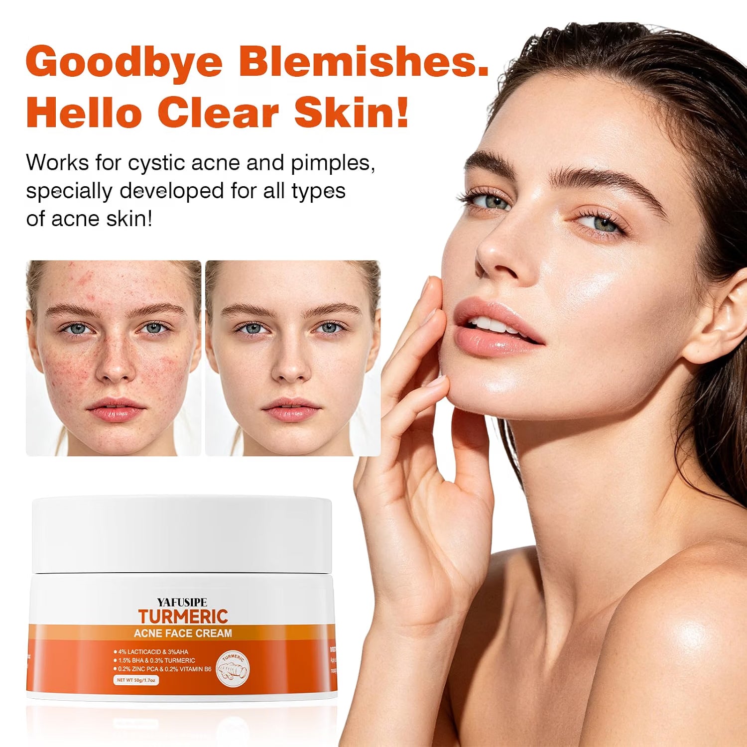YAFUSIPE Turmeric Acne Cream Pimple Spot Treatment for Face Back Body Butt 1.7OZ