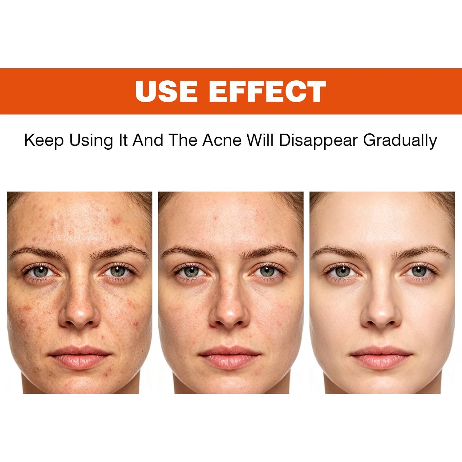 YAFUSIPE Turmeric Acne Cream Pimple Spot Treatment for Face Back Body Butt 1.7OZ