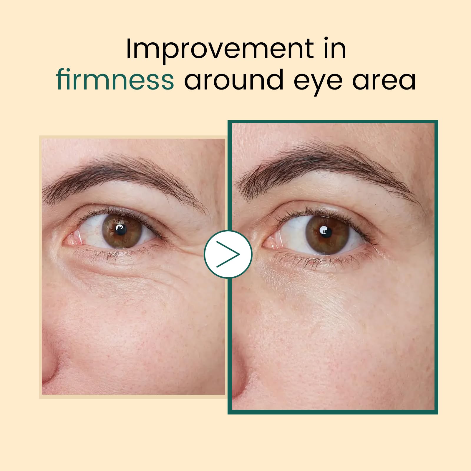 Salmon DNA PDRN Eye Serum