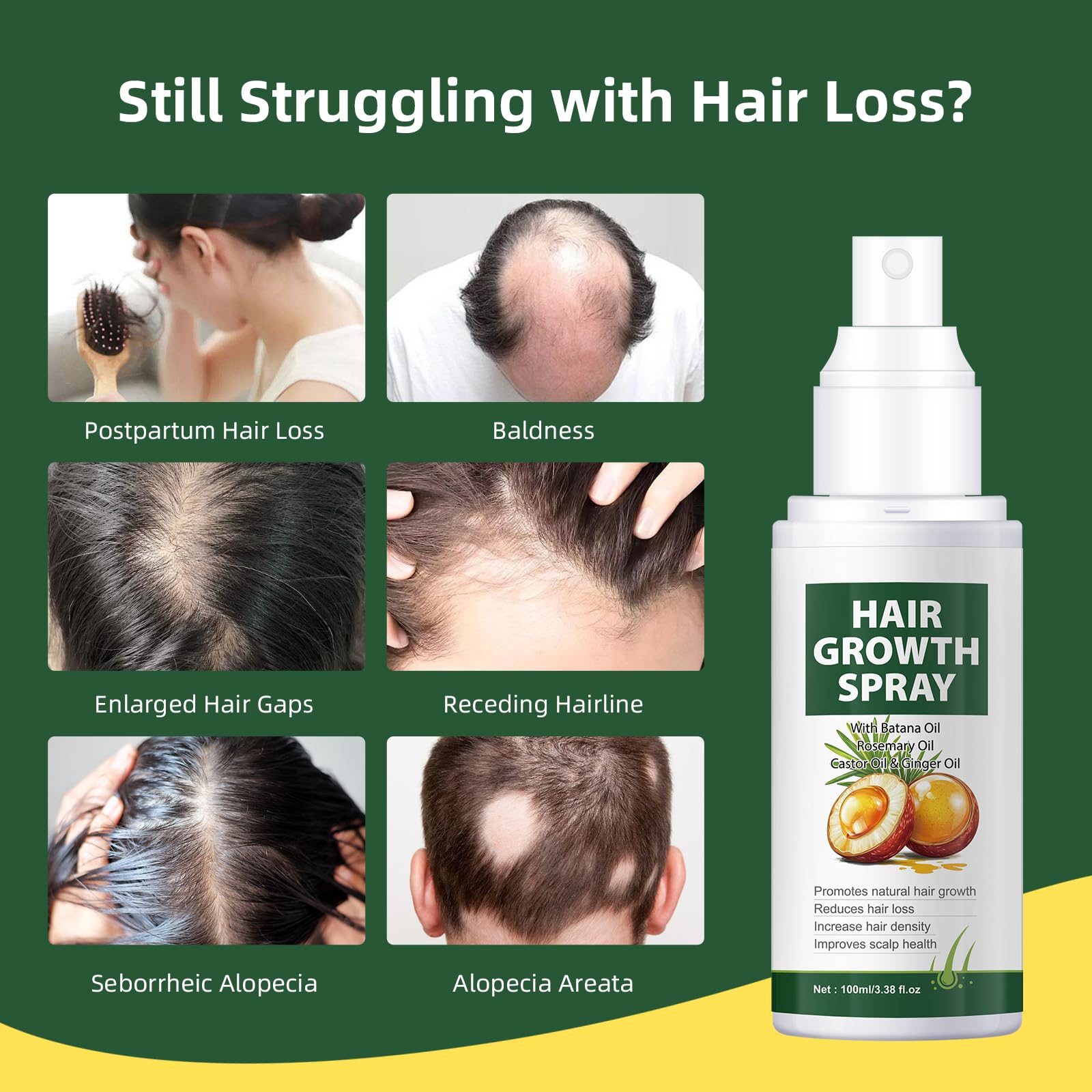 Hair Growth Oil Spray With Batana Oil
