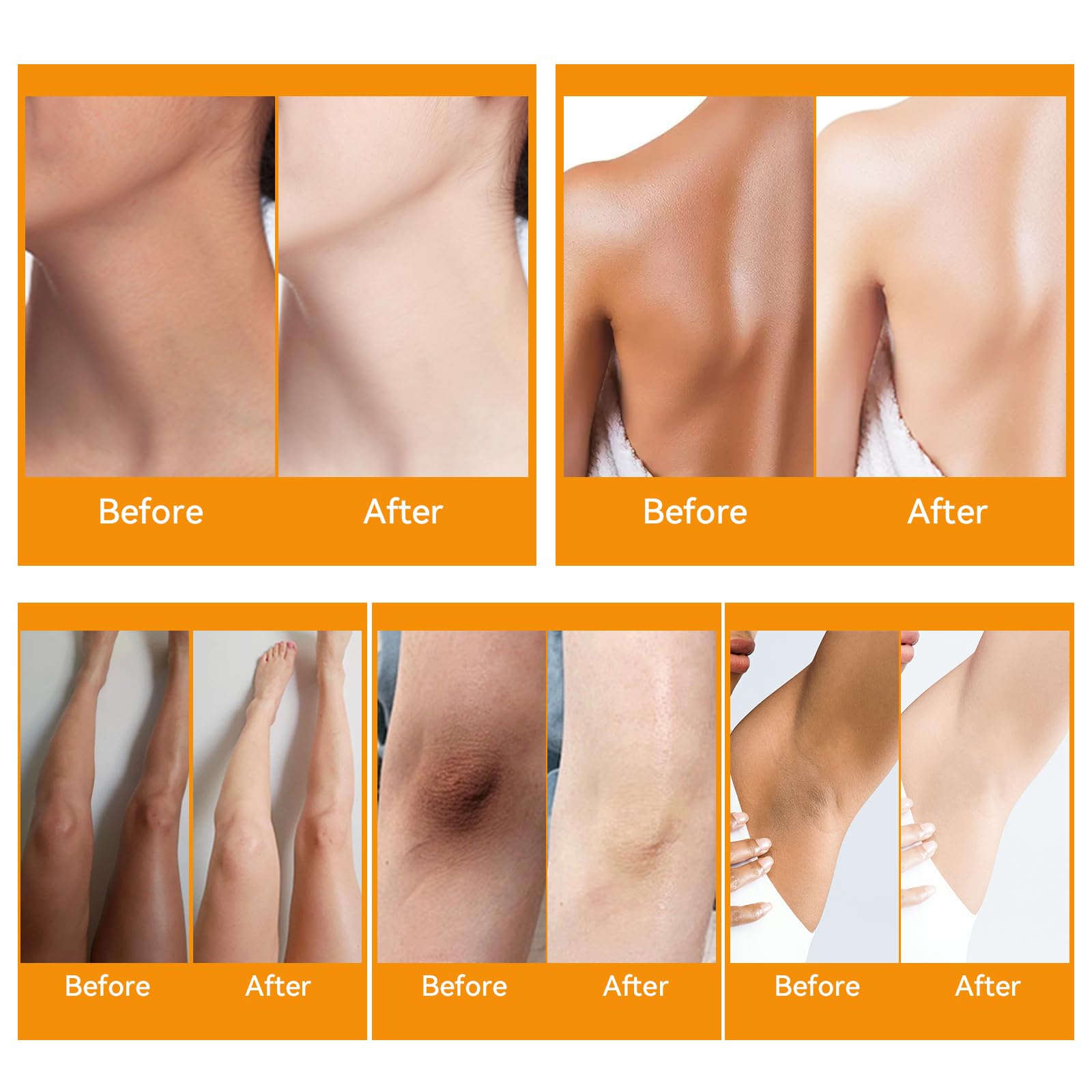 Dark Knees and Elbows Thighs Niacinamide Cream