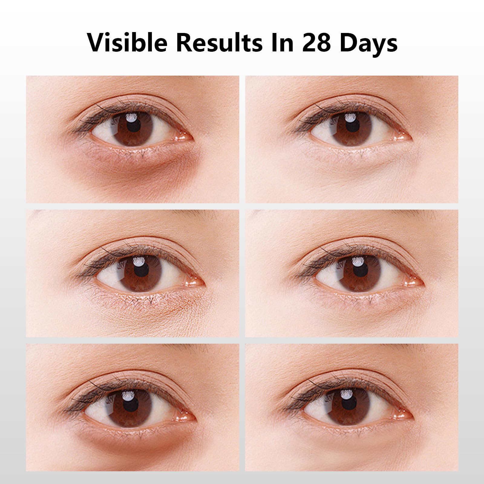 360°  Eye Patches with Salmon DNA PDRN