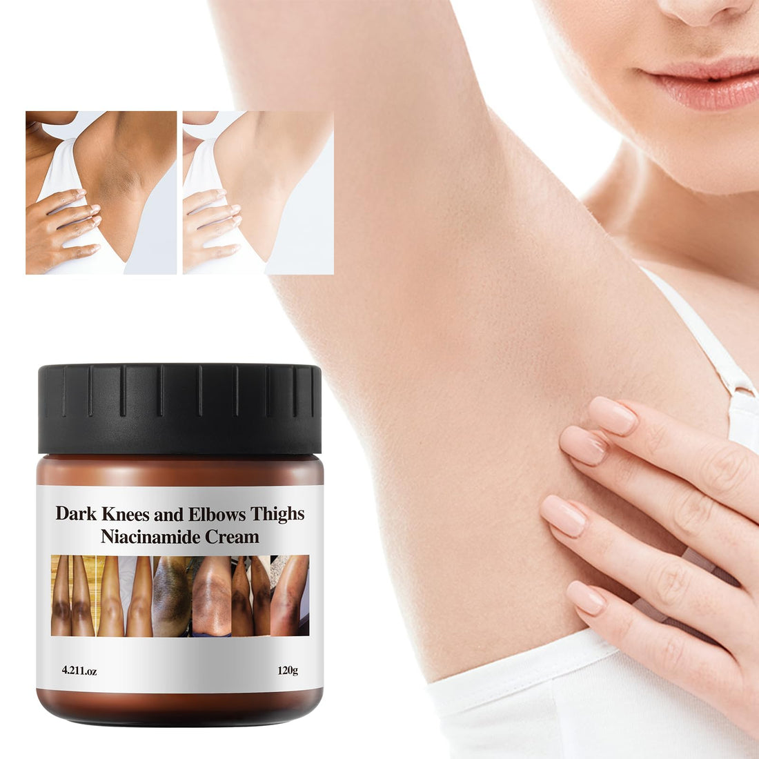 Dark Knees and Elbows Thighs Niacinamide Cream