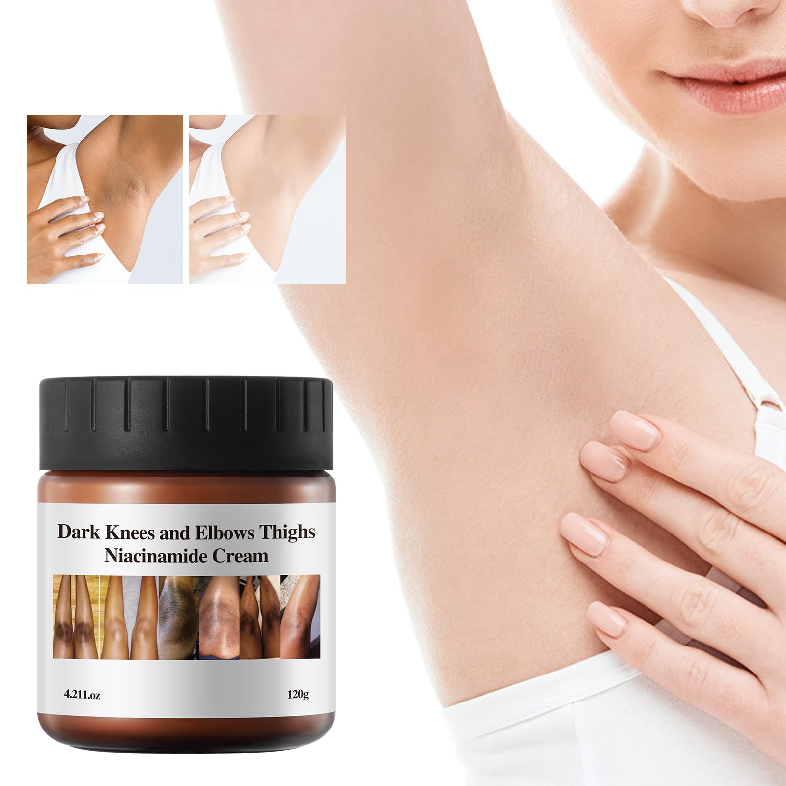 Dark Knees and Elbows Thighs Niacinamide Cream