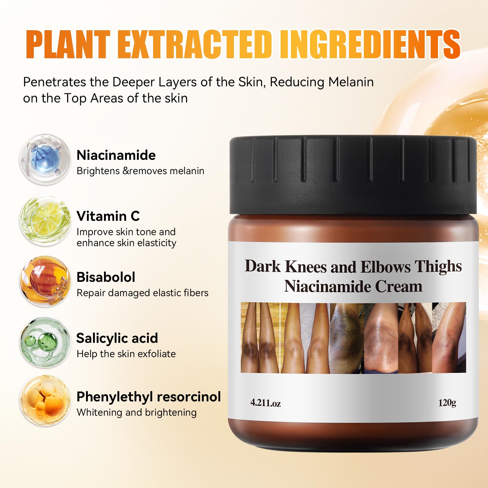 Dark Knees and Elbows Thighs Niacinamide Cream