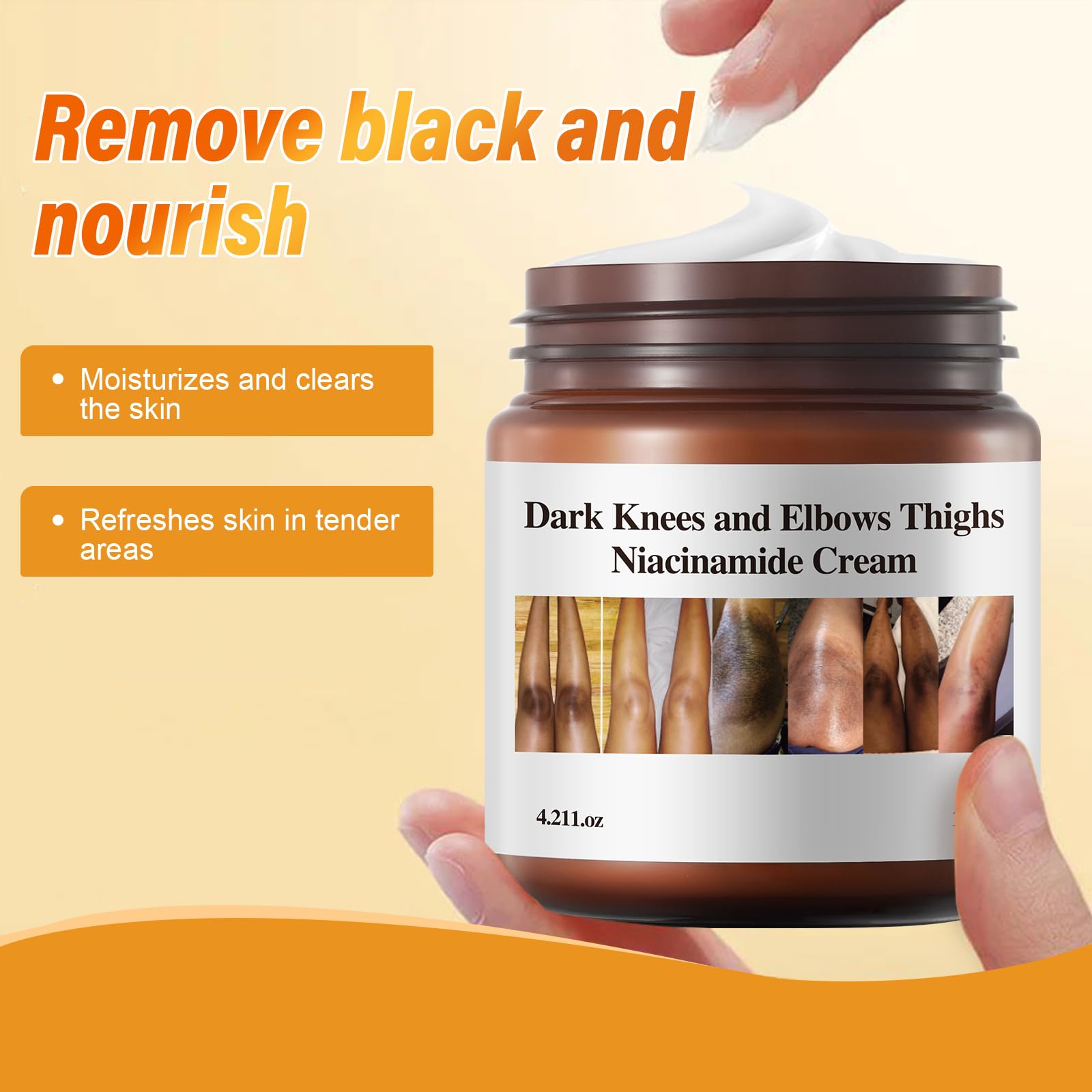 Dark Knees and Elbows Thighs Niacinamide Cream