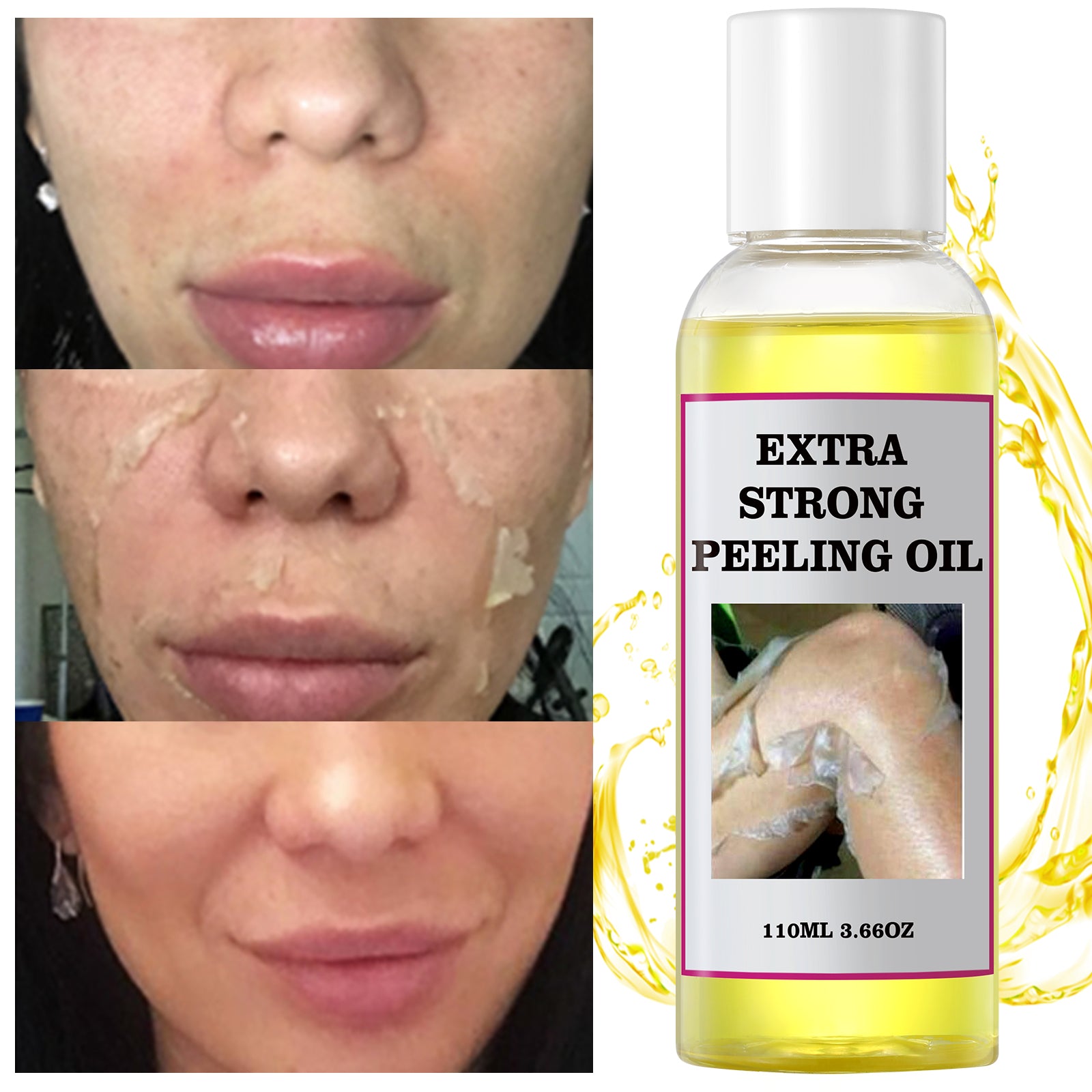 YAFUSIPE Yellow Peeling Oil for Dark Skin Strong Peel Oil Extra Strength Exfoliating Chemical Exfoliant Peels Solution at Home Body Peeling for Exfoliate Body Hand Foot Knuckle All Skin Type 3.66 OZ