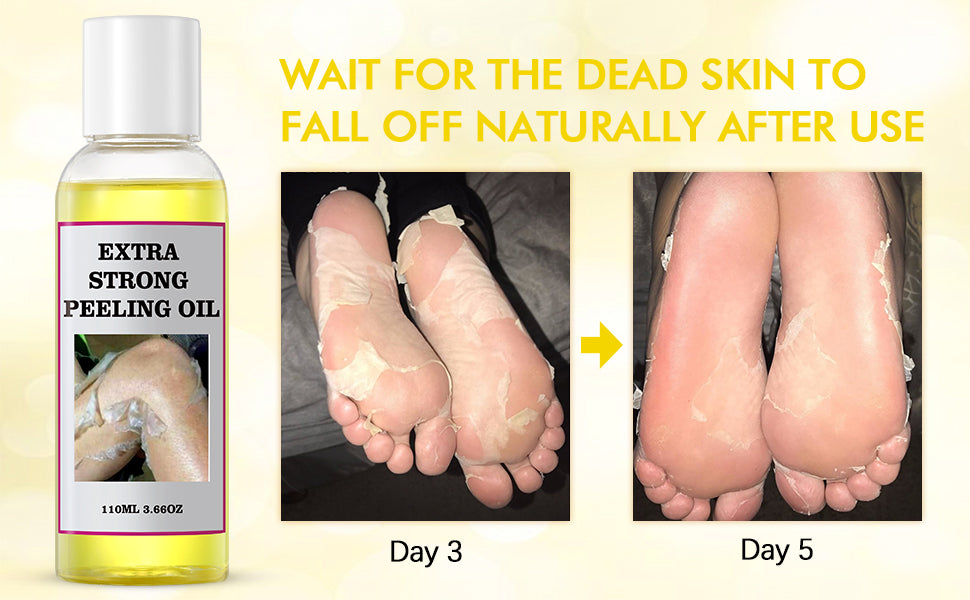 YAFUSIPE Yellow Peeling Oil for Dark Skin Strong Peel Oil Extra Strength Exfoliating Chemical Exfoliant Peels Solution at Home Body Peeling for Exfoliate Body Hand Foot Knuckle All Skin Type 3.66 OZ